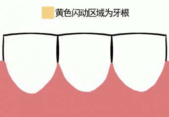 【金测评】扉乐Filix电动牙刷试用:钻石般闪耀的牙刷,给你恰到好处的呵护
